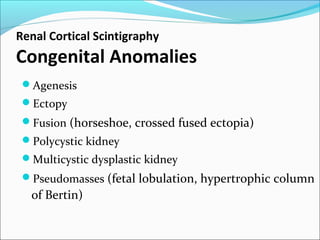Renal Cortical Scintigraphy
Congenital Anomalies
Agenesis
Ectopy
Fusion (horseshoe, crossed fused ectopia)
Polycystic kidney
Multicystic dysplastic kidney
Pseudomasses (fetal lobulation, hypertrophic column
of Bertin)
 