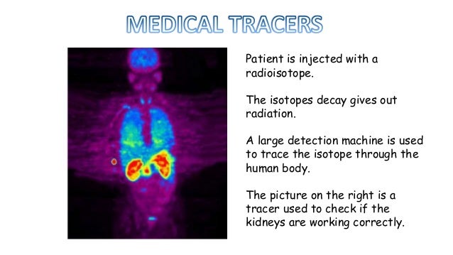 The Uses of Radioisotopes