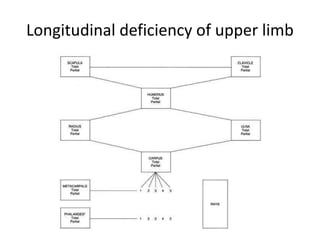 Longitudinal deficiency of upper limb
 