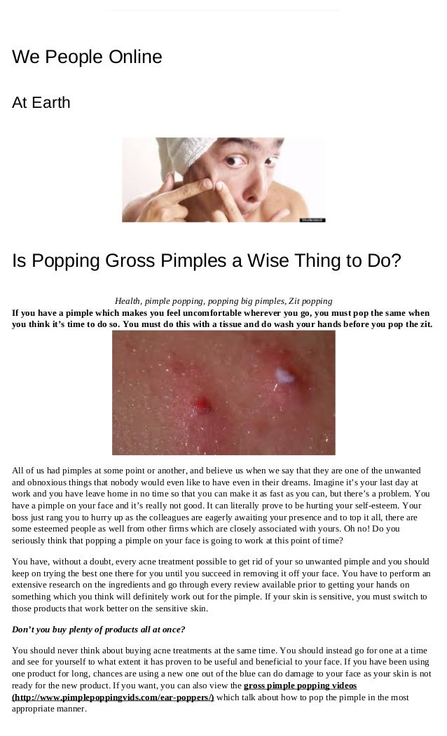 Is Popping Gross Pimples A Wise Thing To Do We People Online