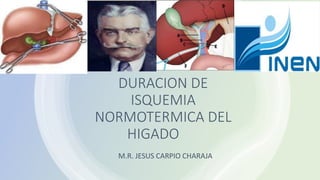 DURACION DE
ISQUEMIA
NORMOTERMICA DEL
HIGADO
M.R. JESUS CARPIO CHARAJA
 