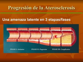 Progresi ó n  de la  Aterosclerosis Una amenaza latente en  3  etapas/f ases 