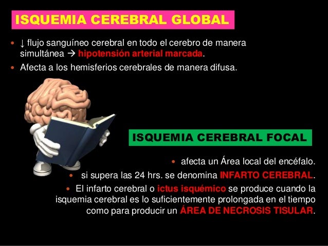 Isquemia cerebral johann butron