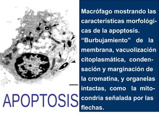 Macrófago mostrando las
características morfológi-
cas de la apoptosis.
“Burbujamiento” de la
membrana, vacuolización
citoplasmática, conden-
sación y marginación de
la cromatina, y organelas
intactas, como la mito-
condria señalada por las
flechas.
 