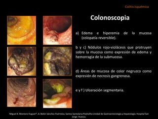 Isquemia Intestinal Juance 2 PPTX isquemia-intestinal-juance-2-pptx