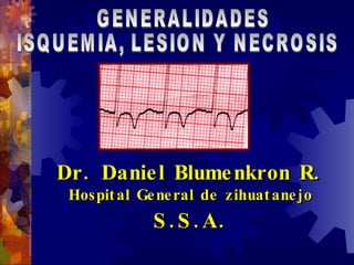 Dr. Daniel Blumenkron R. Hospital General de zihuatanejo S.S.A. GENERALIDADES ISQUEMIA, LESION Y NECROSIS 