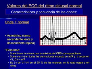 Onda T normal
• Asimétrica (rama
ascendente lenta y
descendente rápida)
Características y secuencia de las ondas:
Valores del ECG del ritmo sinusal normal
• Polaridad:
• Suele tener la misma que la máxima del QRS correspondiente
• Suele ser (+) en todas las derivaciones excepto en aVR y a veces en
V1, D3 y aVF
• Es (-) de V1-V4 en el 25 % de las mujeres, en la raza negra y en
niños
 
