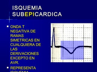 ISQUEMIAISQUEMIA
SUBSUBEPIEPICARDICACARDICA
 ONDA TONDA T
NEGATIVA DENEGATIVA DE
RAMASRAMAS
SIMETRICAS ENSIMETRICAS EN
CUALQUIERA DECUALQUIERA DE
LASLAS
DERIVACIONESDERIVACIONES
EXCEPTO ENEXCEPTO EN
AVR.AVR.
 REPRESENTAREPRESENTA
 