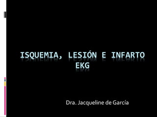 ISQUEMIA, LESIÓN E INFARTO
EKG
Dra. Jacqueline de García
 