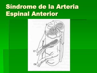 Síndrome de la Arteria
Espinal Anterior

 