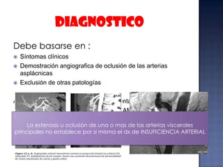 Debe basarse en :





Síntomas clínicos
Demostración angiografica de oclusión de las arterias
asplácnicas
Exclusión de otras patologías

ANGIOGRAFIA : aortografia en vista frontal y lateral
inyección selectiva en AMS – AC - AMI
La estenosis u oclusión de una o mas de las arterias viscerales
principales no establece por si misma el dx de INSUFICIENCIA ARTERIAL

 