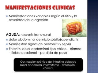 

Manifestaciones variables según el sitio y la
severidad de la agresión

AGUDA: necrosis transmural
dolor abdominal de inicio súbito(apendicitis)
 Manifiestan signos de peritonitis y sepsis
 Enteritis: dolor abdominal tipo cólico – diarrea
– fiebre ocasional – perdida de peso


Obstrucción crónica del intestino delgado
Dolor abdominal intermitente – distensión vómitos

 