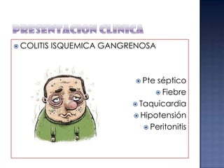  COLITIS

ISQUEMICA GANGRENOSA

 Pte

séptico
 Fiebre
 Taquicardia
 Hipotensión
 Peritonitis

 