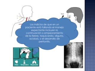 Los indicios de que en un
paciente está fallando el manejo
expectante incluyen la
continuación o empeoramiento
de la fiebre, taquicardia, oliguria,
acidosis, o el desarrollo de
peritonitis.

 