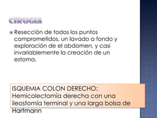  Resección

de todos los puntos
comprometidos, un lavado a fondo y
exploración de el abdomen, y casi
invariablemente la creación de un
estoma.

ISQUEMIA COLON DERECHO:
Hemicolectomía derecha con una
ileostomía terminal y una larga bolsa de
Hartmann

 