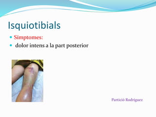 Isquiotibials
 Símptomes:
 dolor intens a la part posterior
Partició Rodríguez
 