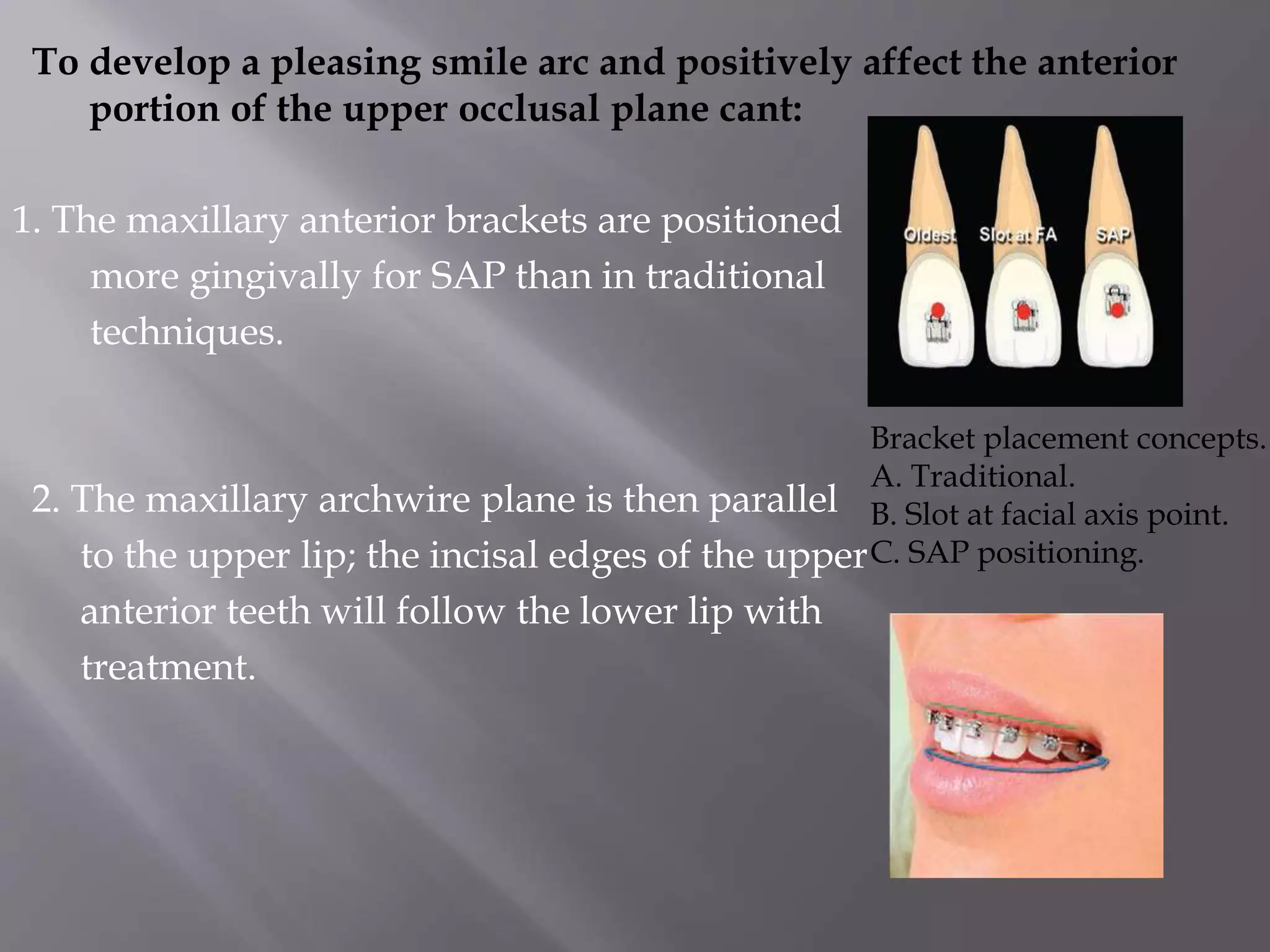 bracket positioning for smile arc protection | PPTX