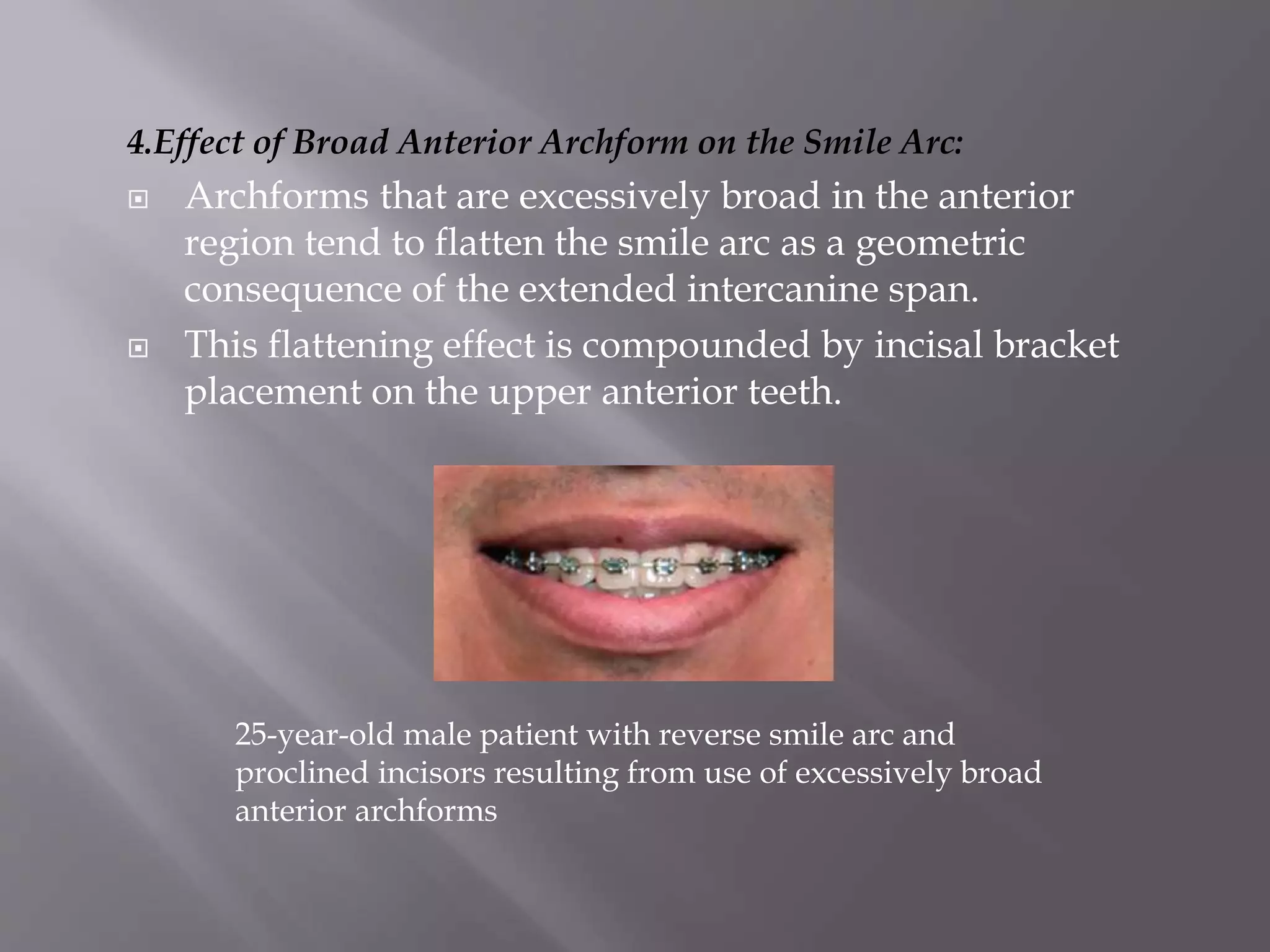 4.Effect of Broad Anterior Archform on the Smile Arc:
 Archforms that are excessively broad in the anterior
region tend to flatten the smile arc as a geometric
consequence of the extended intercanine span.
 This flattening effect is compounded by incisal bracket
placement on the upper anterior teeth.
25-year-old male patient with reverse smile arc and
proclined incisors resulting from use of excessively broad
anterior archforms
 