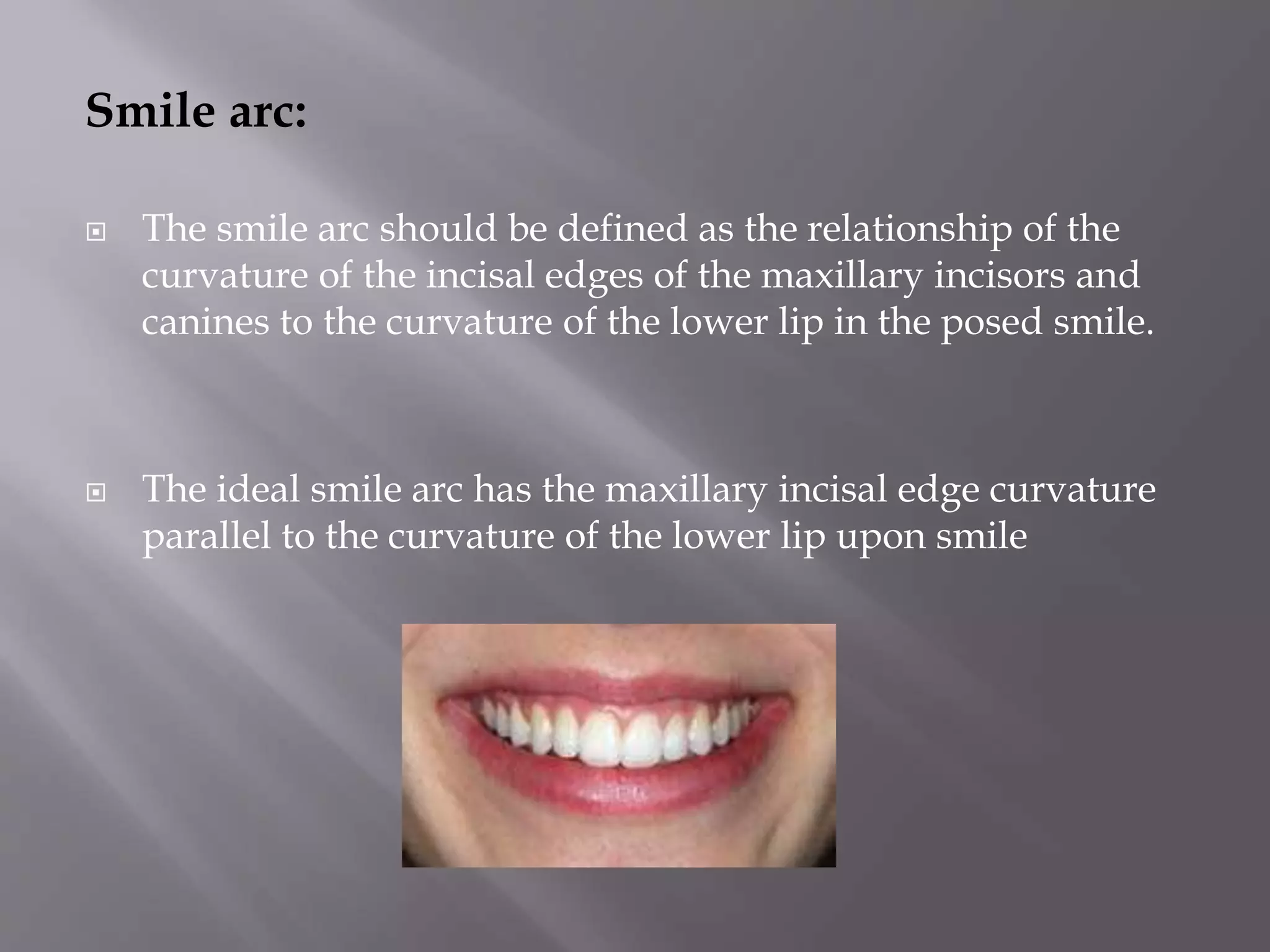 bracket positioning for smile arc protection | PPTX