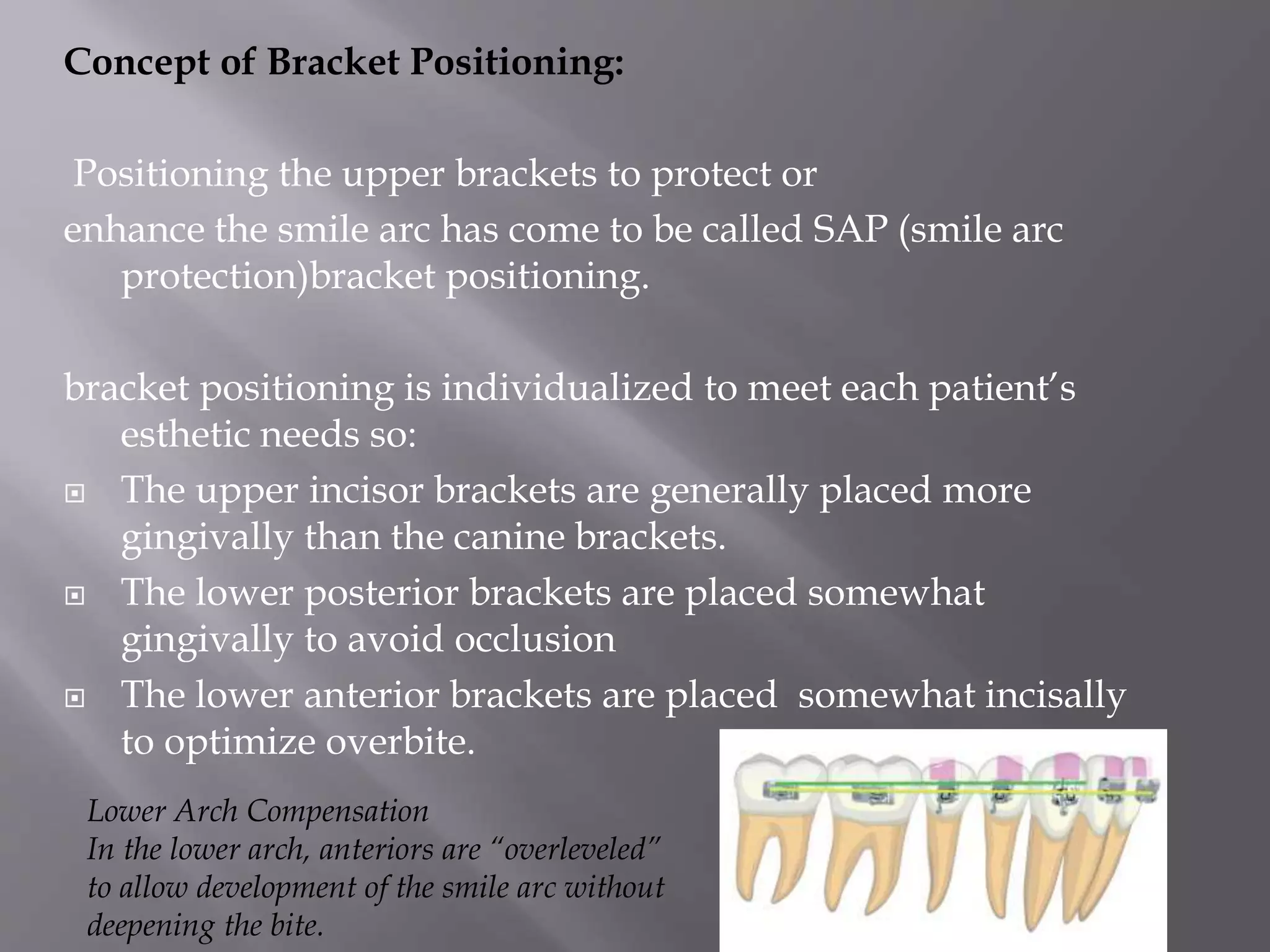 Concept of Bracket Positioning:
Positioning the upper brackets to protect or
enhance the smile arc has come to be called SAP (smile arc
protection)bracket positioning.
bracket positioning is individualized to meet each patient’s
esthetic needs so:
 The upper incisor brackets are generally placed more
gingivally than the canine brackets.
 The lower posterior brackets are placed somewhat
gingivally to avoid occlusion
 The lower anterior brackets are placed somewhat incisally
to optimize overbite.
Lower Arch Compensation
In the lower arch, anteriors are “overleveled”
to allow development of the smile arc without
deepening the bite.
 