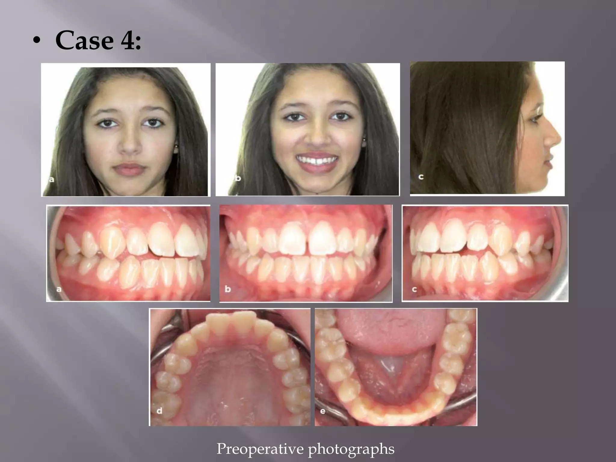 • Case 4:
Preoperative photographs
 