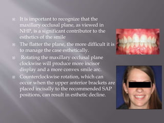  It is important to recognize that the
maxillary occlusal plane, as viewed in
NHP, is a significant contributor to the
esthetics of the smile
 The flatter the plane, the more difficult it is
to manage the case esthetically.
 Rotating the maxillary occlusal plane
clockwise will produce more incisor
display and a more convex smile arc.
 Counterclockwise rotation, which can
occur when the upper anterior brackets are
placed incisally to the recommended SAP
positions, can result in esthetic decline.
 