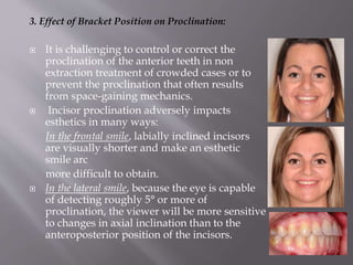 3. Effect of Bracket Position on Proclination:
 It is challenging to control or correct the
proclination of the anterior teeth in non
extraction treatment of crowded cases or to
prevent the proclination that often results
from space-gaining mechanics.
 Incisor proclination adversely impacts
esthetics in many ways:
In the frontal smile, labially inclined incisors
are visually shorter and make an esthetic
smile arc
more difficult to obtain.
 In the lateral smile, because the eye is capable
of detecting roughly 5° or more of
proclination, the viewer will be more sensitive
to changes in axial inclination than to the
anteroposterior position of the incisors.
 