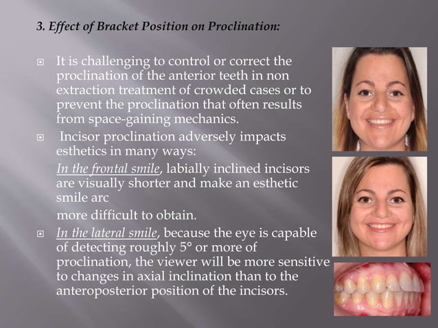 bracket positioning for smile arc protection | PPTX