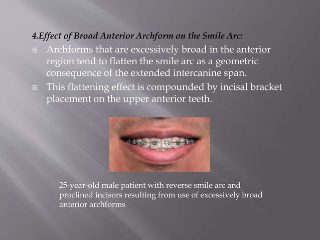 bracket positioning for smile arc protection | PPTX