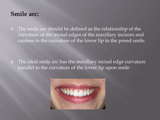 Smile arc:
 The smile arc should be defined as the relationship of the
curvature of the incisal edges of the maxillary incisors and
canines to the curvature of the lower lip in the posed smile.
 The ideal smile arc has the maxillary incisal edge curvature
parallel to the curvature of the lower lip upon smile
 