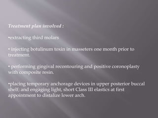 Treatment plan involved :
•extracting third molars
• injecting botulinum toxin in masseters one month prior to
treatment.
• performing gingival recontouring and positive coronoplasty
with composite resin.
•placing temporary anchorage devices in upper posterior buccal
shelf; and engaging light, short Class III elastics at first
appointment to distalize lower arch.
 