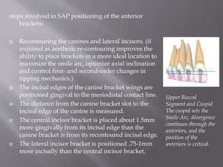 steps involved in SAP positioning of the anterior
brackets:
 Recontouring the canines and lateral incisors. (if
required as aesthetic re-contouring improves the
ability to place brackets in a more ideal location to
maximize the smile arc, optimize axial inclination
and control first- and second-order changes in
tipping mechanics.)
 The incisal edges of the canine bracket wings are
positioned gingival to the mesiodistal contact line.
 The distance from the canine bracket slot to the
incisal edge of the canine is measured.
 The central incisor bracket is placed about 1.5mm
more gingivally from its incisal edge than the
canine bracket is from its recontoured incisal edge.
 The lateral incisor bracket is positioned .75-1mm
more incisally than the central incisor bracket.
Upper Buccal
Segment and Cuspid
The cuspid sets the
Smile Arc, divergence
continues through the
anteriors, and the
position of the
anteriors is critical.
 