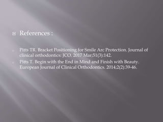  References :
o Pitts TR. Bracket Positioning for Smile Arc Protection. Journal of
clinical orthodontics: JCO. 2017 Mar;51(3):142.
o Pitts T. Begin with the End in Mind and Finish with Beauty.
European Journal of Clinical Orthodontics. 2014;2(2):39-46.
 