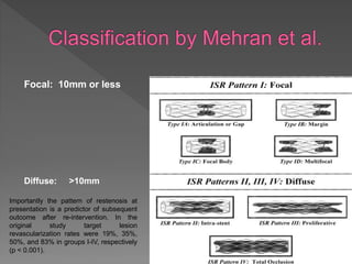 Focal: 10mm or less
Diffuse: >10mm
Importantly the pattern of restenosis at
presentation is a predictor of subsequent
outcome after re-intervention. In the
original study target lesion
revascularization rates were 19%, 35%,
50%, and 83% in groups I-IV, respectively
(p < 0.001).
 