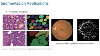 ● Medical imaging
Image source: DRIVE Digital Retinal Image Vessel Extraction
Segmentation Applications
 
