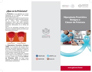 La Próstata es una glándula que existe
solamente en el hombre, de tamaño
aproximado de una nuez.
Es un órgano interno que se encuentra en la
pelvis, envuelve y rodea la primera porción
de la uretra, estas características
anatómicas hacen que todos procesos
patológicos que se generen en la glándula
produzcan alteraciones en la forma de
orinar.
Una de las principales funciones de la
próstata es producir líquido prostático que
forma parte del semen.
La Hiperplasia Prostática Benigna
(HPB), es el aumento del tamaño de la
próstata, que puede provocar obstrucción
en el flujo urinario (dificultad o dolor al
orinar) y es la enfermedad más frecuente
en los hombres mayores de 40 años.
Cuando existe una proliferación anormal
de las células de está glándula, se genera
un tumor, dando como resultado Cáncer
de Próstata (CP), no tiene causa
aparente, sin embargo se considera una
enfermedad multifactorial.
Directorio
Institucional
Lic. José Reyes Baeza
Dirección General
Dr. Rafael Navarro Meneses
Dirección Médica
Dra. Vesta L. Richardson López
Collada
Subdirección de Prevención y
Protección a la Salud
Hiperplasia Prostática
Benigna o
Cáncer de Próstata
¡Estamos moviendo al ISSSTE,
moviendo a México!
www.issste.gob.mx
¿Que es la Próstata?
/ISSSTE.MX
issste.mx
@ISSSTE_mx
ISSSTE MX
 