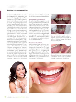 ΣΑΚΧΑΡΩΔΗΣ ΔΙΑΒΗΤΗΣ | ΦΡΟΝΤΙΔΑ ΓΙΑ ΟΛΟΥΣ | 1-3/201442
του στοματικού βλεννογόνου σε ποσο-
στό έως και 30% των περιπτώσεων, μίας
ευκαιριακής λοίμωξης, που οφείλεται
συνηθέστερα στον μύκητα Candida
albicans και εκδηλώνεται κλινικά με
τη μορφή λευκών αποκολλώμενων
πλακών σε ερυθηματώδη βάση (ψευ-
δομεμβρανώδης καντιντίαση), ερυθρών
περιοχών (ερυθηματώδης καντιντίαση),
συγχειλίτιδας, ή διάχυτης ερυθρότητας
του βλεννογόνου, στον οποίο επικάθο-
νται οδοντοστοιχίες (στοματίτιδα από
οδοντοστοιχίες). Ο πτωχός γλυκαιμικός
έλεγχος, η συνυπάρχουσα ξηροστο-
μία, ιδιαίτερα σε συνδυασμό με το
κάπνισμα, αλλά και οι διαταραχές στη
λειτουργία των ουδετερόφιλων πολυ-
μορφοπυρήνων αποτελούν παράγο-
ντες που συμβάλλουν στην εμφάνιση
καντιντίασης του στοματικού βλεννο-
γόνου. Από την άλλη πλευρά, καθώς η
παρουσία καντιντίασης στη στοματική
κοιλότητα υποδηλώνει την πτώση της
ανοσολογικής άμυνας σε τοπικό, ή συ-
στηματικό επίπεδο, είναι δυνατόν η διε-
ρεύνηση για τα αίτια εμφάνισης της λοί-
μωξης να οδηγήσει σε διάγνωση του
ΣΔ σε άτομα που αγνοούν την ύπαρξη
της νόσου. Η θεραπεία της καντιντίασης
συνίσταται στην τοπική, ή συστηματική
χορήγηση αντιμυκητιασικών φαρμάκων.
Νευροαισθητικές διαταραχές:
Οι ασθενείς με ΣΔ υποφέρουν συχνά
από νευροαισθητήριες διαταραχές, ως
αποτέλεσμα των μικροαγγειακών με-
ταβολών, που συνοδεύουν τη νόσο,
παραπονούμενοι συχνά για καυσαλγία
του στοματικού βλεννογόνου, γλωσσο-
δυνία και διαταραχές στη γεύση. Η μειω-
μένη αίσθηση γευστικής οξύτητας είναι
δυνατόν να οδηγεί σε υπερφαγία και
αδυναμία τήρησης υγεινών διαιτητικών
συνηθειών, με αποτέλεσμα την εμφάνι-
ση παχυσαρκίας και, κατά συνέπεια, τον
πτωχό γλυκαιμικό έλεγχο.
Προκαρκινικές βλάβες:
Νεότερες ερευνητικές μελέτες σε πει-
ραματικά μοντέλα καρκινογένεσης
δείχνουν ότι η παρουσία του ΣΔ επάγει
την έκφραση μορίων όπως τα erbB3,
erb3, p53, ets-1, IRS-1, που σχετίζονται
με αυξημένο κυτταρικό πολλαπλασι-
ασμό, γεγονός που υποδηλώνει, ότι
ο ΣΔ μπορεί, δυνητικά, να οδηγεί σε
αυξημένο κίνδυνο ανάπτυξης καρκίνου
της στοματικής κοιλότητας. x
1
2
3
Εικόνες 1,2. Δύο περιοδοντικά απο-
στήματα στην άνω και κάτω γνάθο σε
ασθενή ηλικίας 45 ετών με αδιάγνωστο
σακχαρώδη διαβήτη.
Εικόνα 3. Καθυστέρηση της επούλωσης
μετεξακτικού φατνίου ένα μήνα μετά την
εξαγωγή γομφίου στον ίδιο ασθενή.
διαβήτης στην καθημερινή ζωή
 