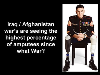 Iraq / Afghanistan war’s are seeing the highest percentage of amputees since what War? 