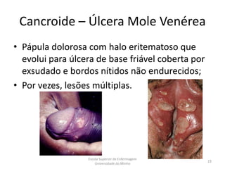 Cancroide – Úlcera Mole Venérea
• Pápula dolorosa com halo eritematoso que
  evolui para úlcera de base friável coberta por
  exsudado e bordos nítidos não endurecidos;
• Por vezes, lesões múltiplas.




                  Escola Superior de Enfermagem
                                                   23
                      Universidade do Minho
 