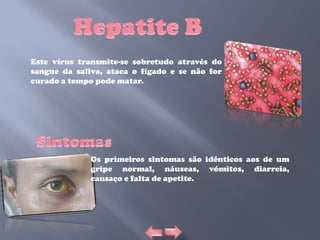 Este vírus transmite-se sobretudo através do
sangue da saliva, ataca o fígado e se não for
curado a tempo pode matar.




              Os primeiros sintomas são idênticos aos de um
              gripe normal, náuseas, vómitos, diarreia,
              cansaço e falta de apetite.
 