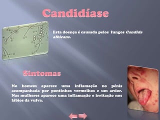Esta doença é causada pelos fungos Candida
                   albicans.




No homem aparece uma inflamação no pénis
acompanhada por pontinhos vermelhos e um ardor.
Nas mulheres aparece uma inflamação e irritação nos
lábios da vulva.
 