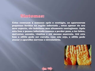 Estes começam 3 semanas após o contágio, ao aparecerem
pequenas feridas na região infectada , estas apesar do seu
mau aspecto, são indolores mas altamente contagiosas. Após
esta fase a pessoa infectada começa a perder peso, a ter febre,
mal-estar, anemia, vómitos e até mesmo anorexia. Até esta
fase a sífilis pode ser curada, caso não seja, a sífilis pode
atacar o aparelho nervoso e circulatório.
 