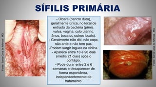 SÍFILIS PRIMÁRIA
- Úlcera (cancro duro),
geralmente única, no local de
entrada da bactéria (pênis,
vulva, vagina, colo uterino,
ânus, boca ou outros locais).
- Geralmente não dói, não coça,
não arde e não tem pus.
-Podem surgir ínguas na virilha.
- Aparece entre 10 e 90 dias
(média 21 dias) após o
contágio.
- Pode durar entre 2 e 6
semanas e desaparecer de
forma espontânea,
independentemente de
tratamento.
Fonte:SantaCasadeAlfenas-MG
Fonte:SantaCasadeAlfenas-MG
 