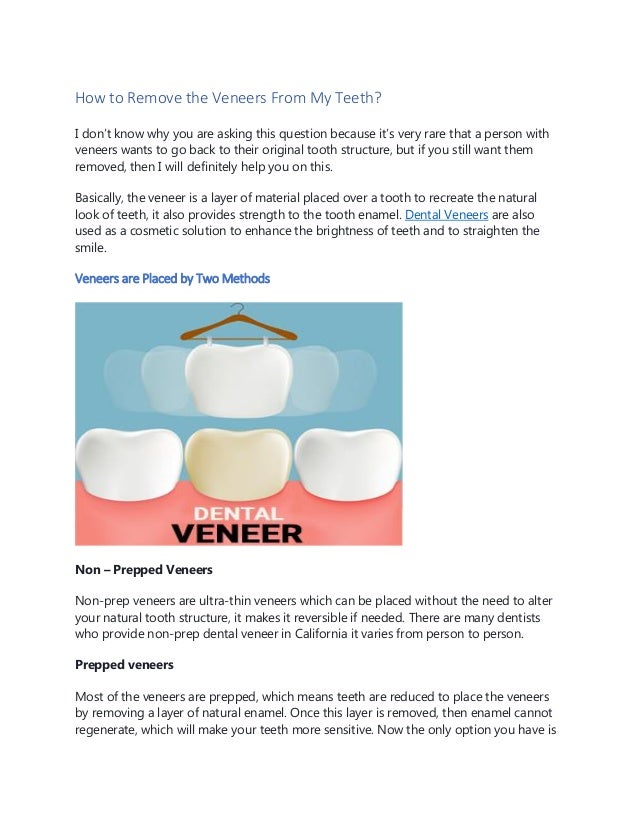How to Remove the Veneers From My Teeth?