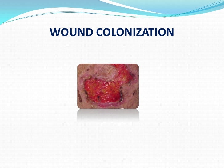 Superficial Critical Colonization From Deep Surrounding Infection