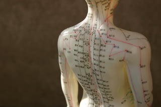 Acupuncture for headache