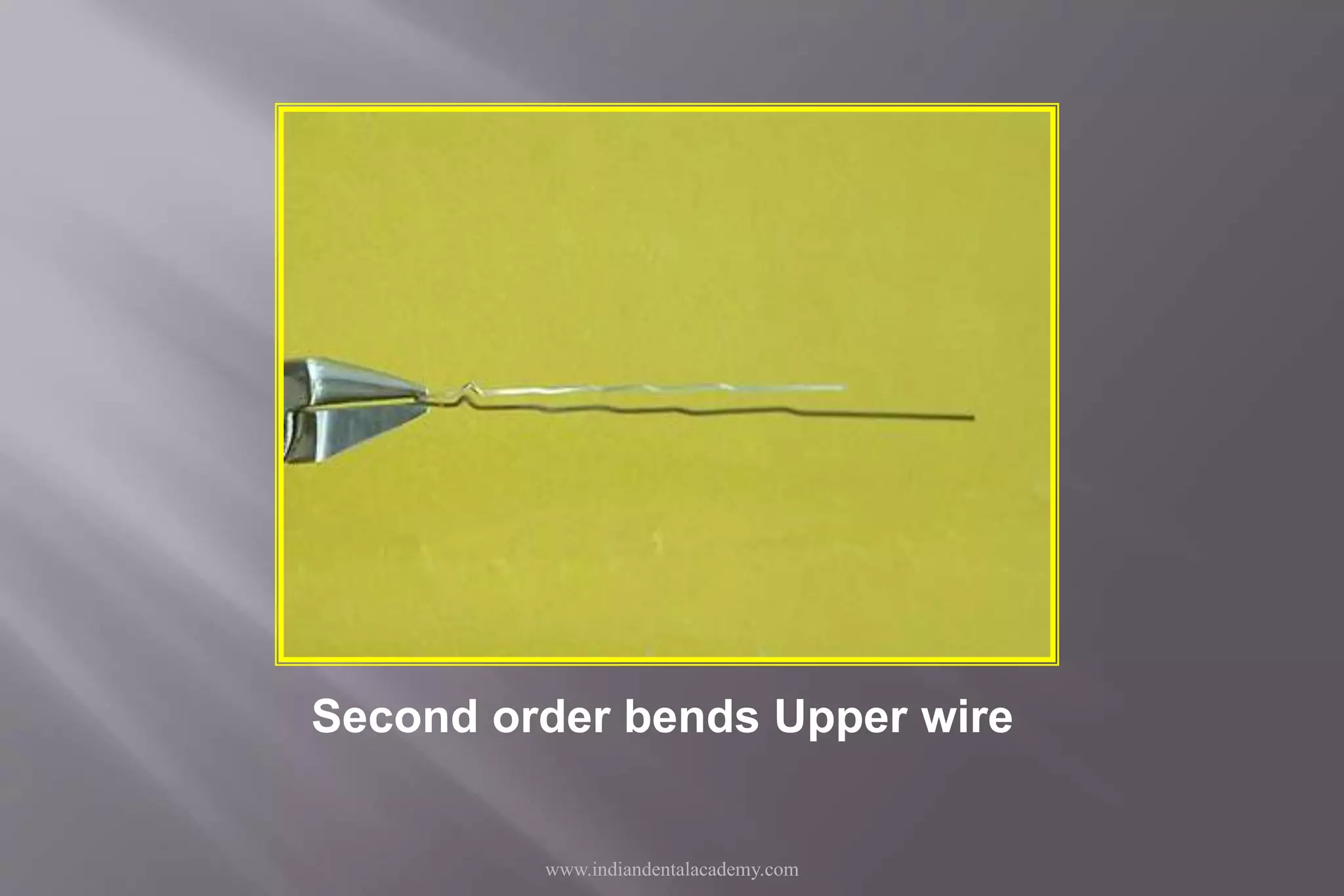 Second order bends Upper wire
www.indiandentalacademy.com
 