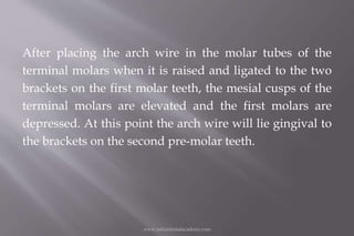 After placing the arch wire in the molar tubes of the
terminal molars when it is raised and ligated to the two
brackets on...
