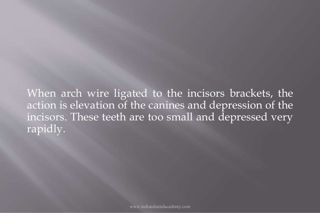 1ST, 2ND AND 3RD ORDER BENDS IN STANDARD EDGEWISE APPLIANCE SYSTEM /F…