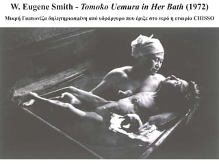 W. Eugene Smith - Tomoko Uemura in Her Bath (1972)
Μηθξή Γηαπσλέδα δειεηεξηαζκέλε από πδξάξγπξν πνπ έξημε ζην λεξό ε εηαηξία CHISSO
 